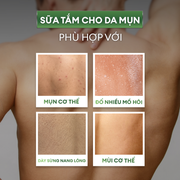 Sữa tắm tẩy tế bào chết & giảm mụn lưng 250ml
