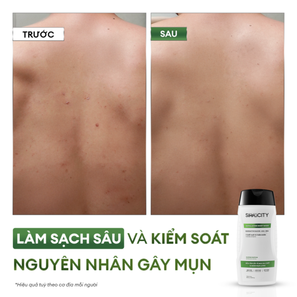 Sữa tắm tẩy tế bào chết & giảm mụn lưng 250ml