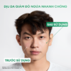 Kem dưỡng Derma Pro Moisturizing 50g