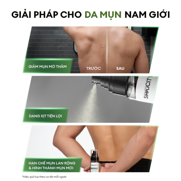 7-13268290-eb80-4b76-93e7-6589f4f9abb2 Xịt giảm mụn và mờ thâm cơ thể Exfoliating Body Spray 100ml