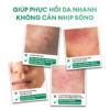 Kem dưỡng Derma Pro Moisturizing 50g