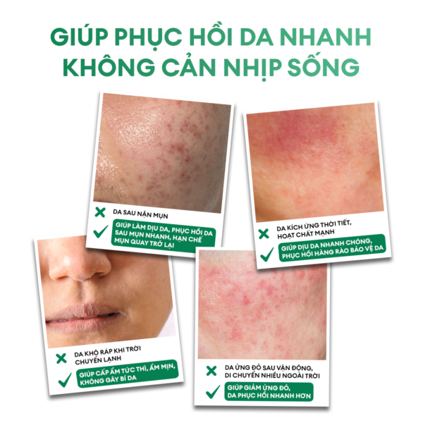 Kem dưỡng Derma Pro Moisturizing 50g