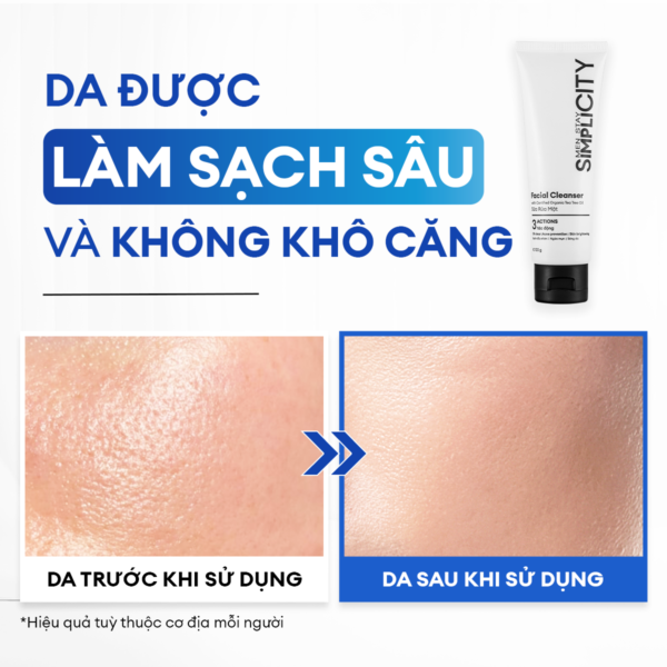 hie-u-qua-185e3cd2-e89c-45e3-aae1-56bf2984c19f Combo 2 tuýp Sữa rửa mặt sạch dầu nhờn, ngừa mụn