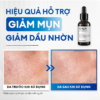 Combo chăm da dầu mụn Acne Trio