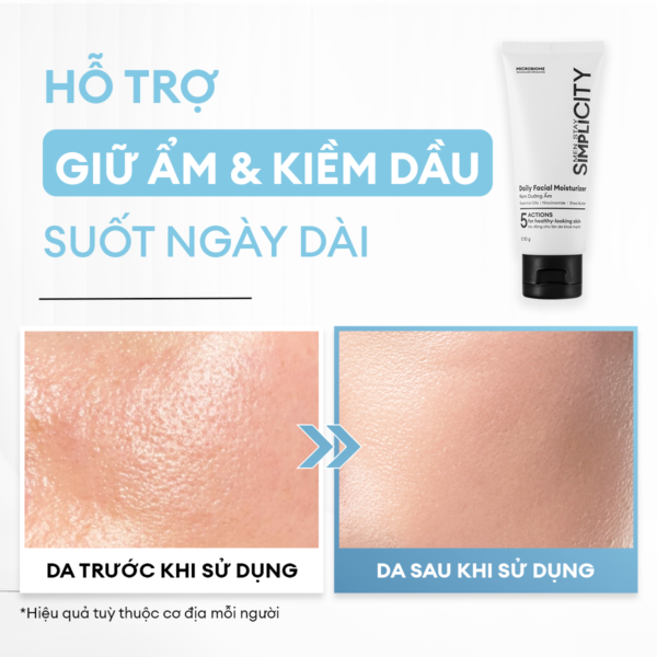 Kem dưỡng ẩm đa năng kiểm soát dầu nhờn 80G