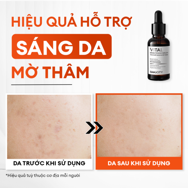 Serum Vital dưỡng trắng mờ thâm 30ml