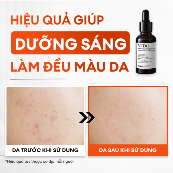 Combo dưỡng trắng mờ thâm tiết kiệm Brightening Duo