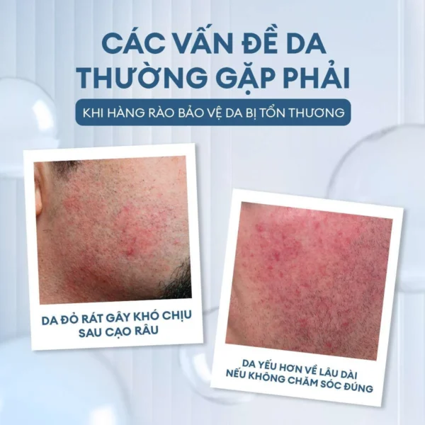 v-n-d-da-3-168224279e5744ceaa0be8cfcf5afd45-master-efcecc447d2043d9a7b20cb265a6031f-master Kem dưỡng sau cạo râu mát lạnh 100ml