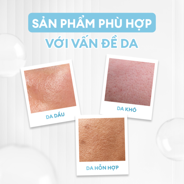 Kem dưỡng ẩm đa năng kiểm soát dầu nhờn 80G