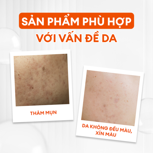 Combo mờ thâm sáng da tiêu chuẩn Brightening Trio