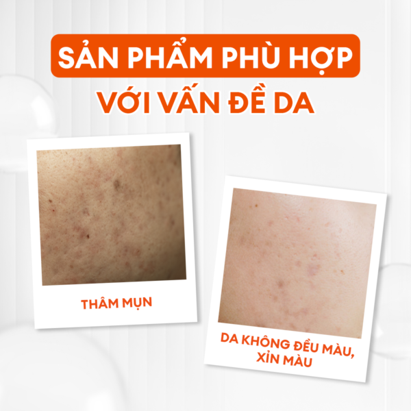 Serum Vital dưỡng trắng mờ thâm 30ml