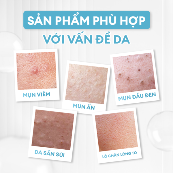 Serum giảm mụn & làm dịu da Calm 10ml